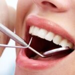 Soins dentaires, implant dentaire : choisir une bonne assurance dentaire