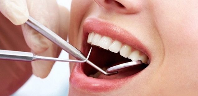 Soins dentaires, implant dentaire : choisir une bonne assurance dentaire